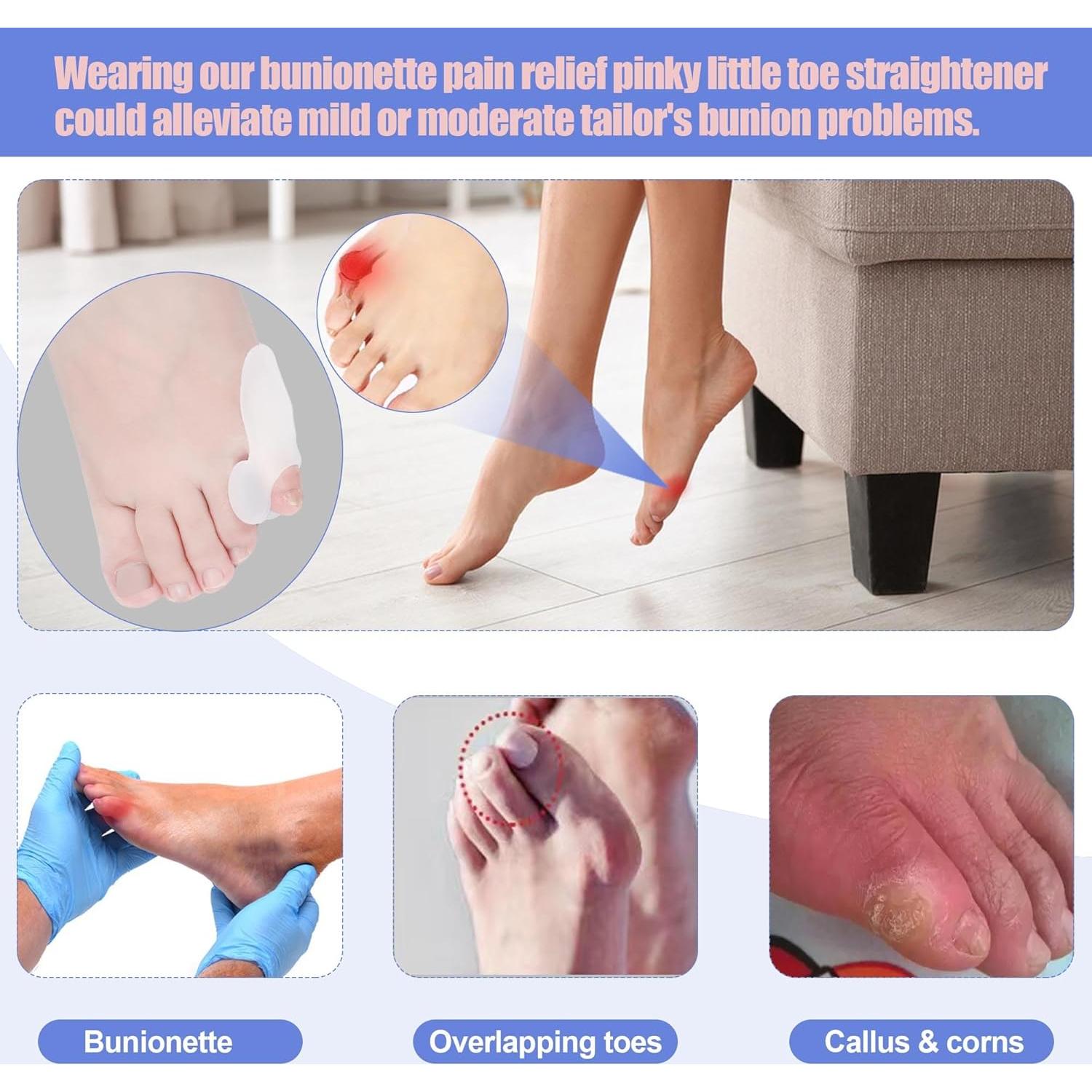 Separadores de Dedo Pequeño de Gel DYKOOK - 3 Pares para Bunionette