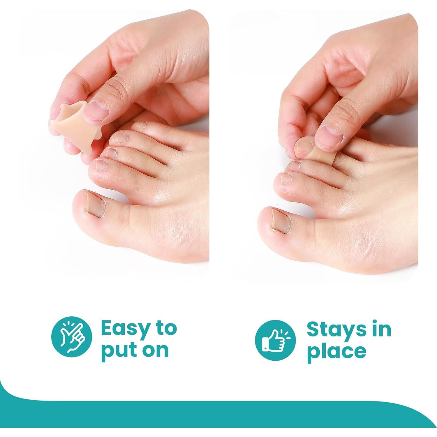 Corrector de Dedo en Martillo Promifun - 6 Piezas Pequeño Beige