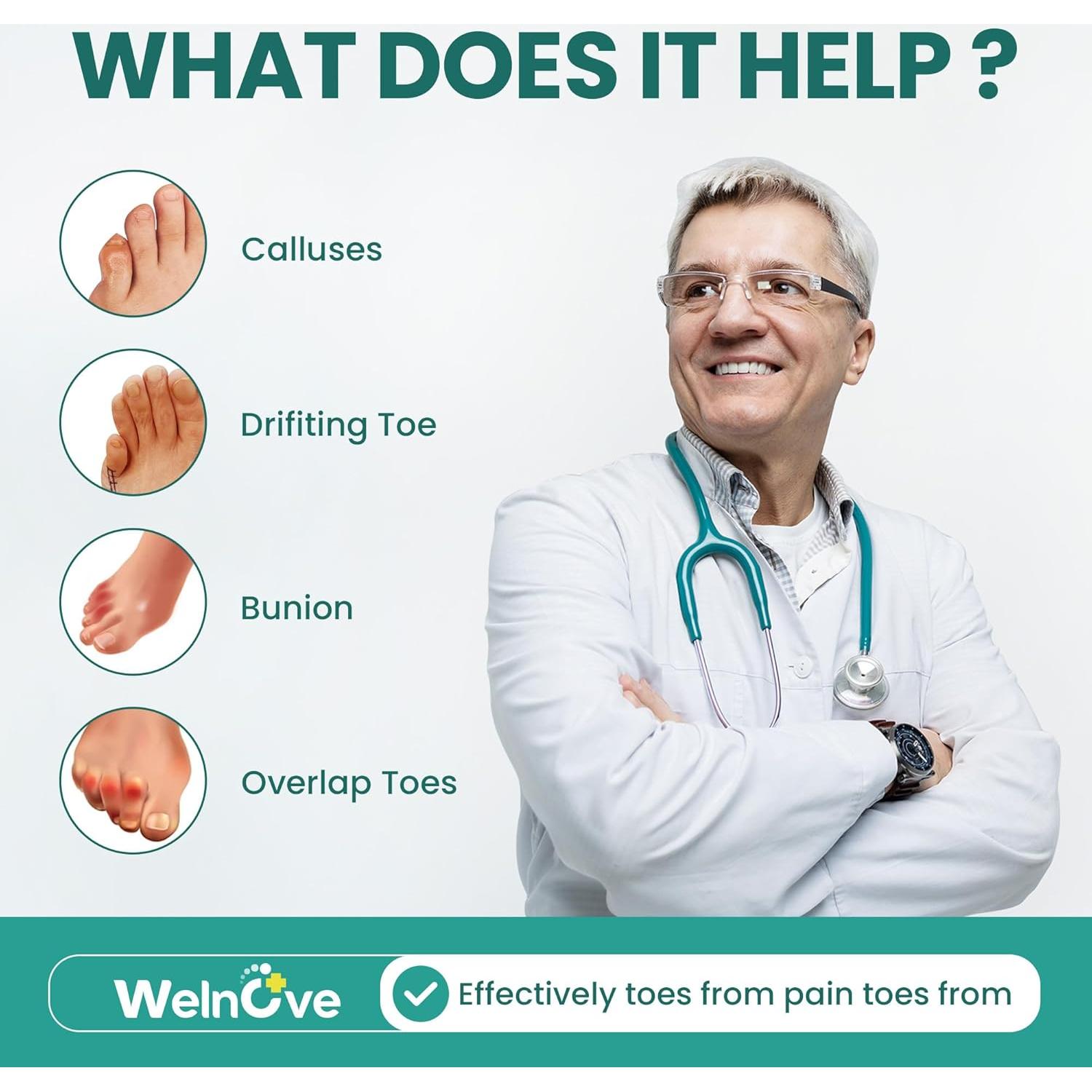 Separadores de Dedos Meñiques Welnove - 8 Piezas de Silicona