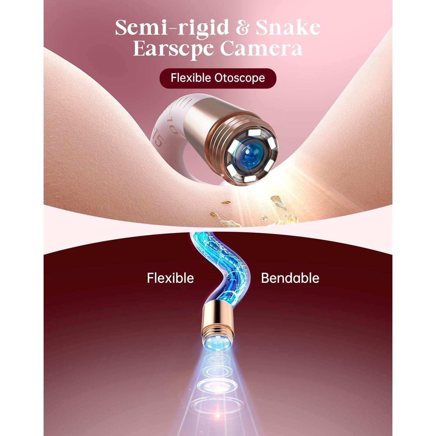 Kit de Limpieza de Oídos con Cámara XLLIKE Rosa - Inalámbrico