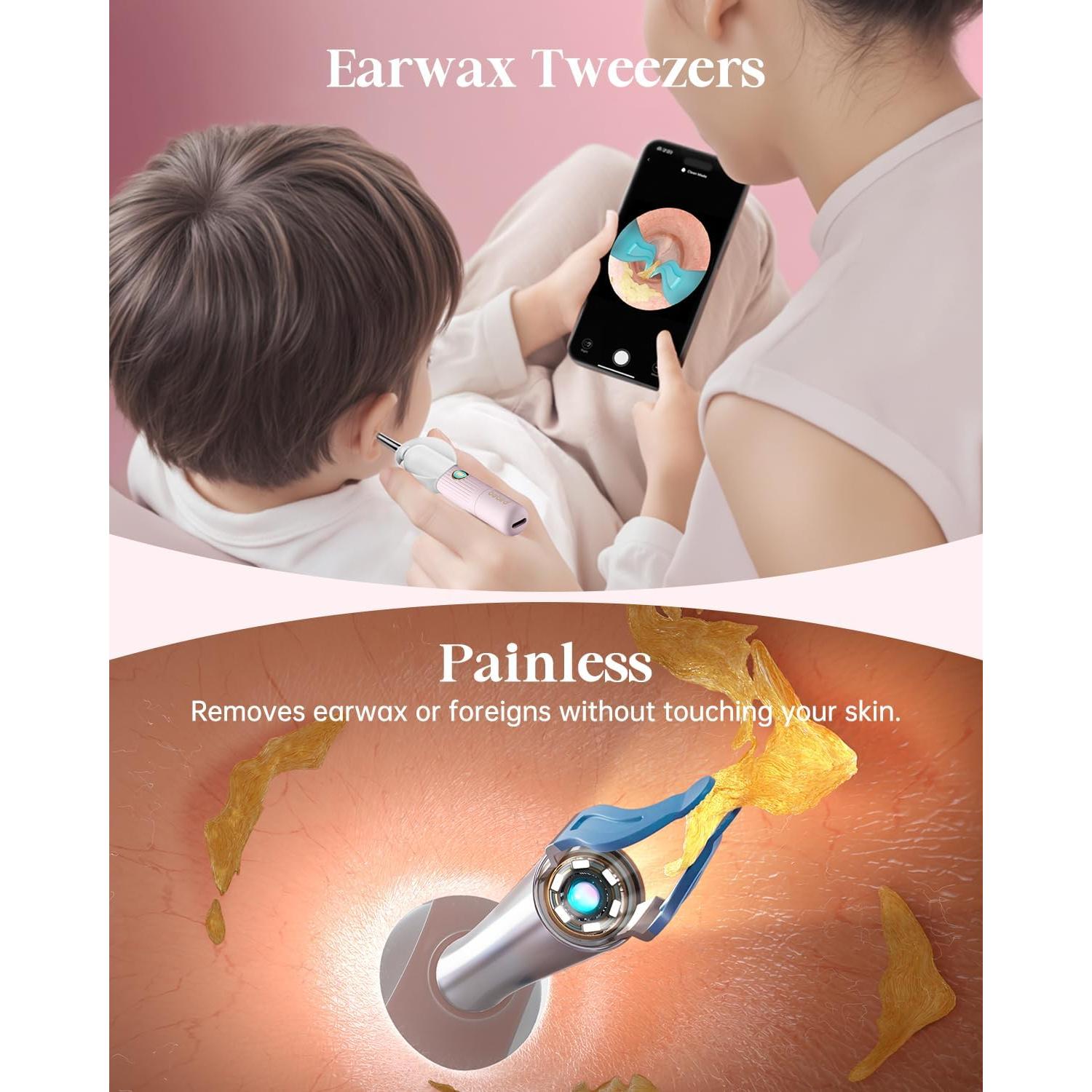 Kit de Limpieza de Oídos con Cámara XLLIKE Rosa - Inalámbrico