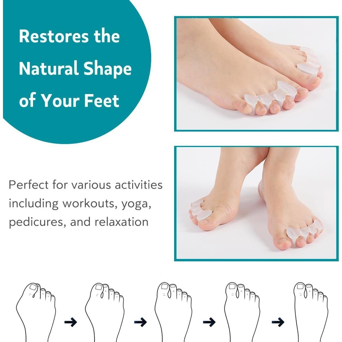 Separadores de Dedos Correctores de Juanetes KIYOKI - Unisex