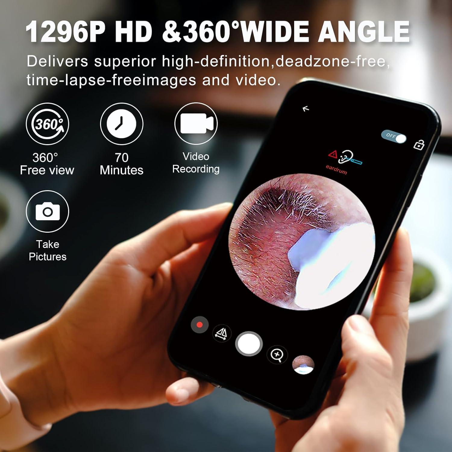 Limpiador de Oídos Nyotall YY10 con Cámara 1296P y Luz LED