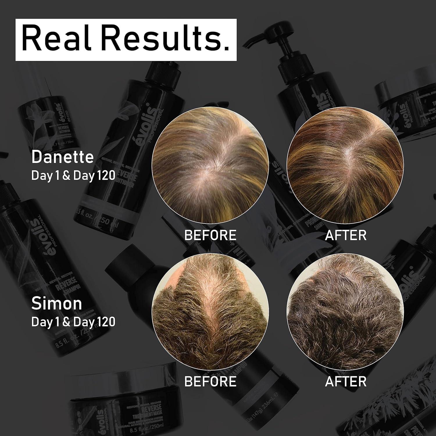 Mascarilla Hidratante Evolis Promote 29.57 ml - Crecimiento Cabello