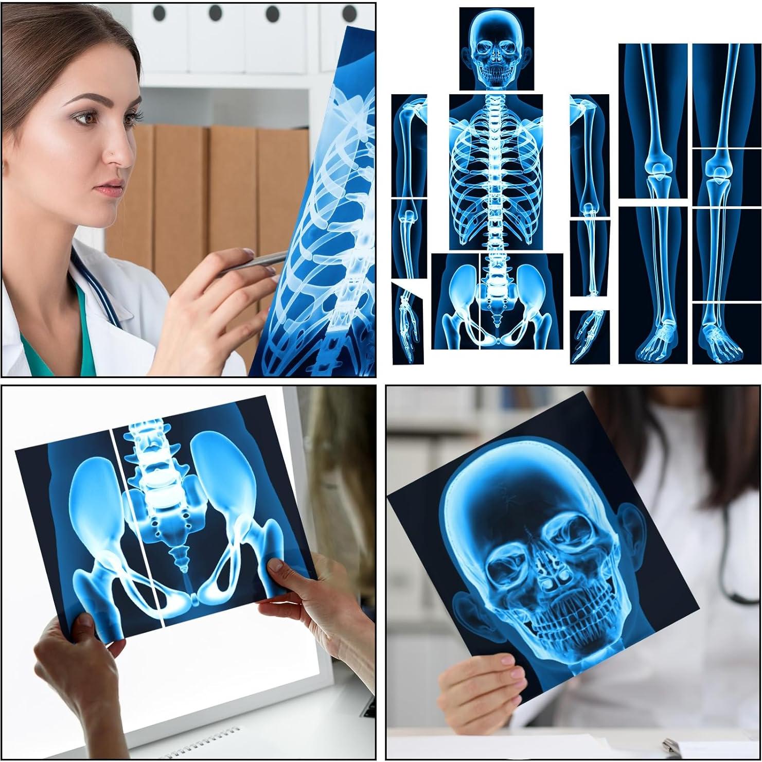 16 Piezas Rayos X Humanos Lineshading Azul para Niños