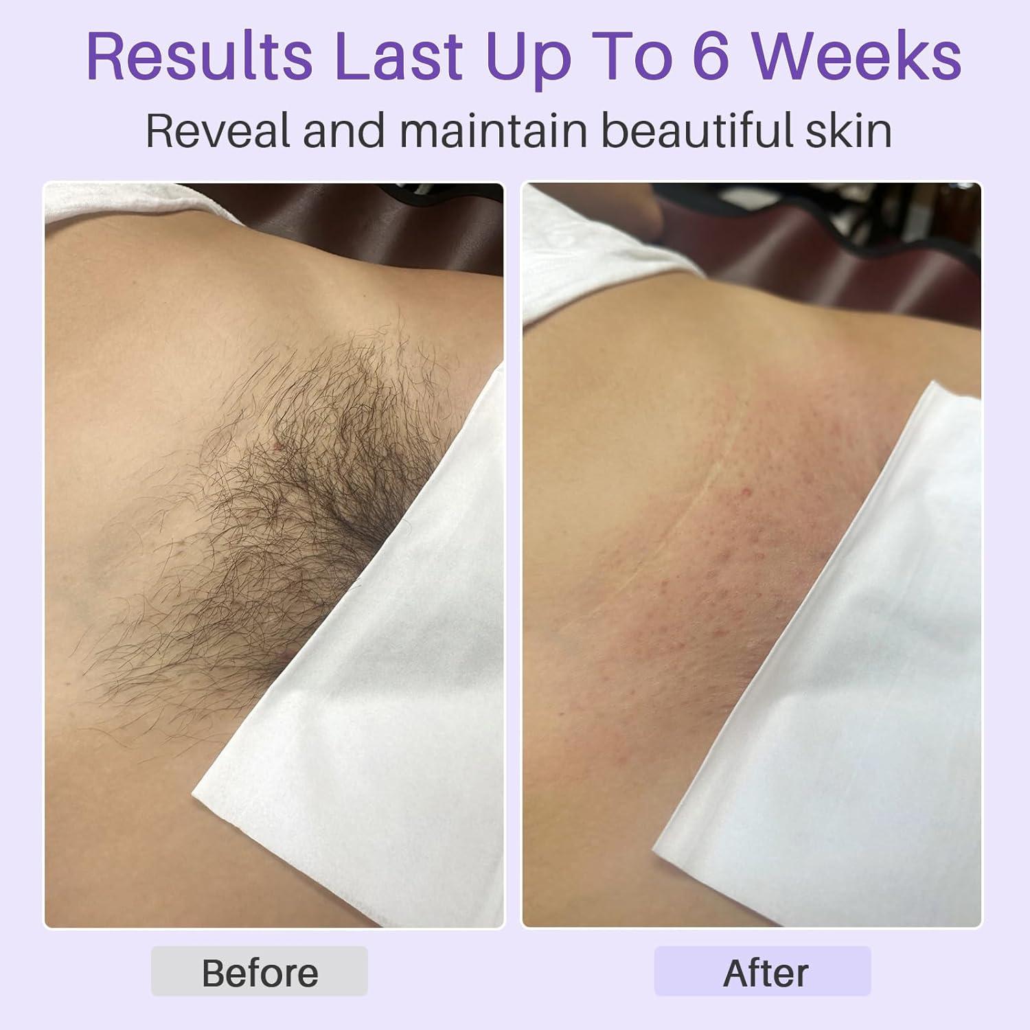 Kit de Depilación con Cera BLITZWAX - 120 Palitos y 30 Papeles