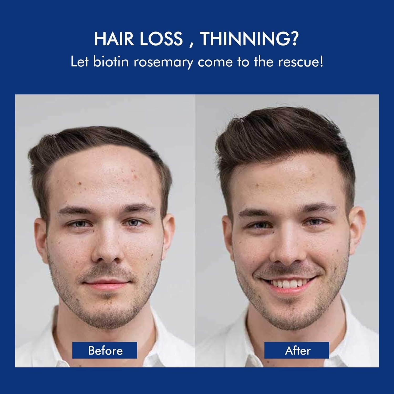 Champú Engrosante Ceson&Cesun 300ml con Romero y Biotina