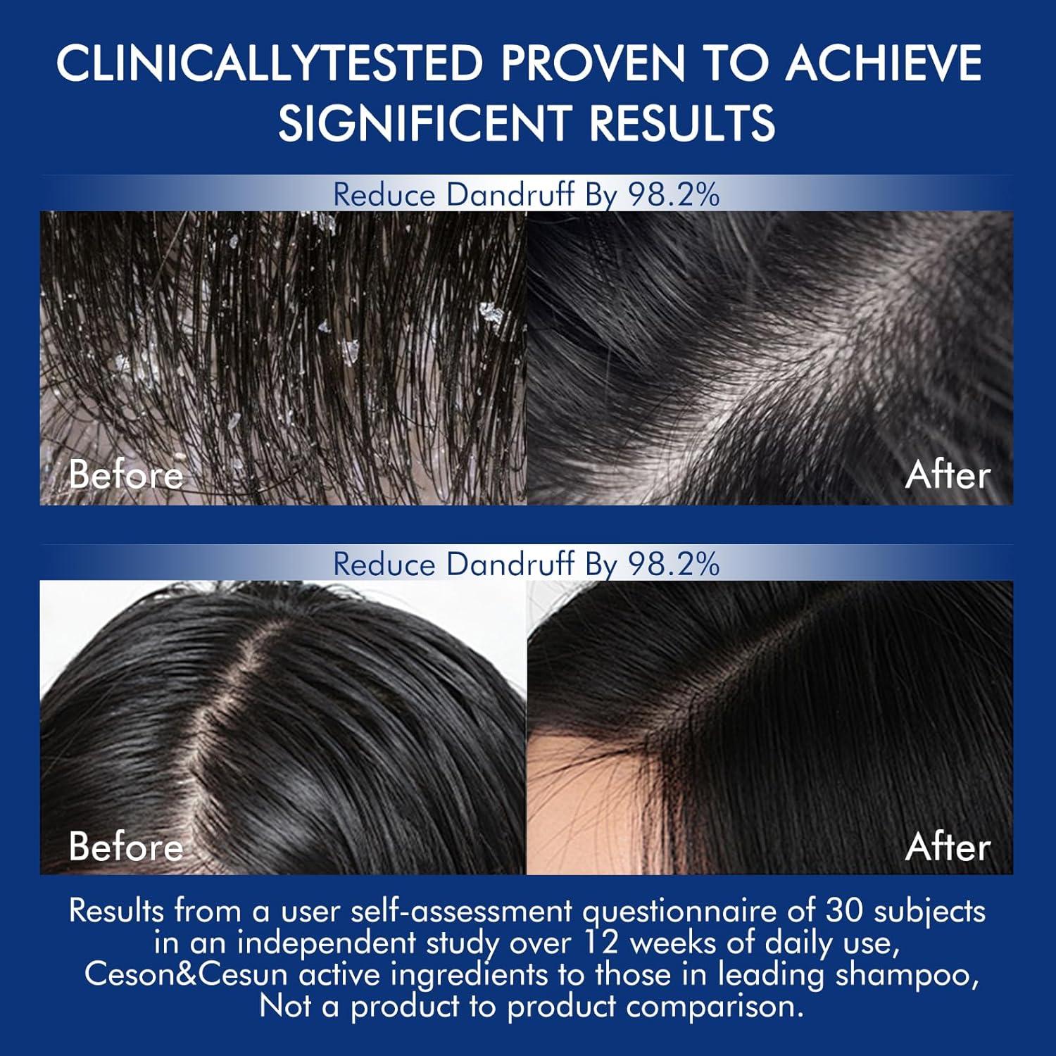 Champú Engrosante Ceson&Cesun 300ml con Romero y Biotina