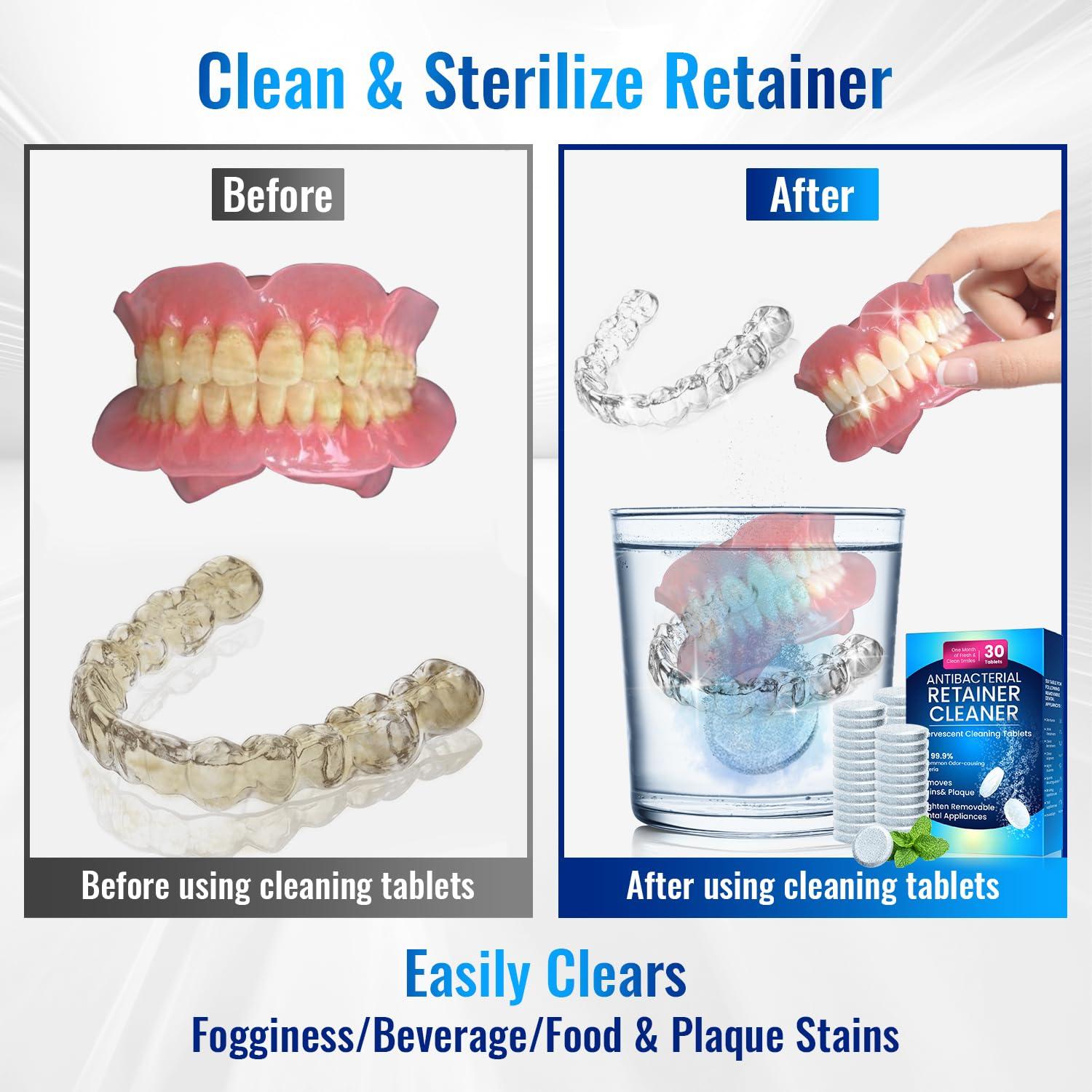 Tabletas Limpiadoras de Retenedores Gyreuni 120 Unidades Sin Sulfatos