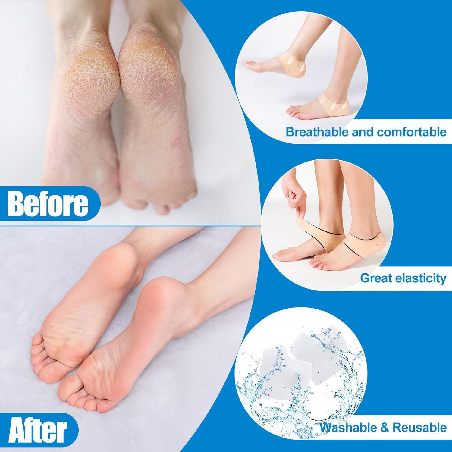 MADHOLLY 5 Pares Protectores de Talón de Silicona Transpirables