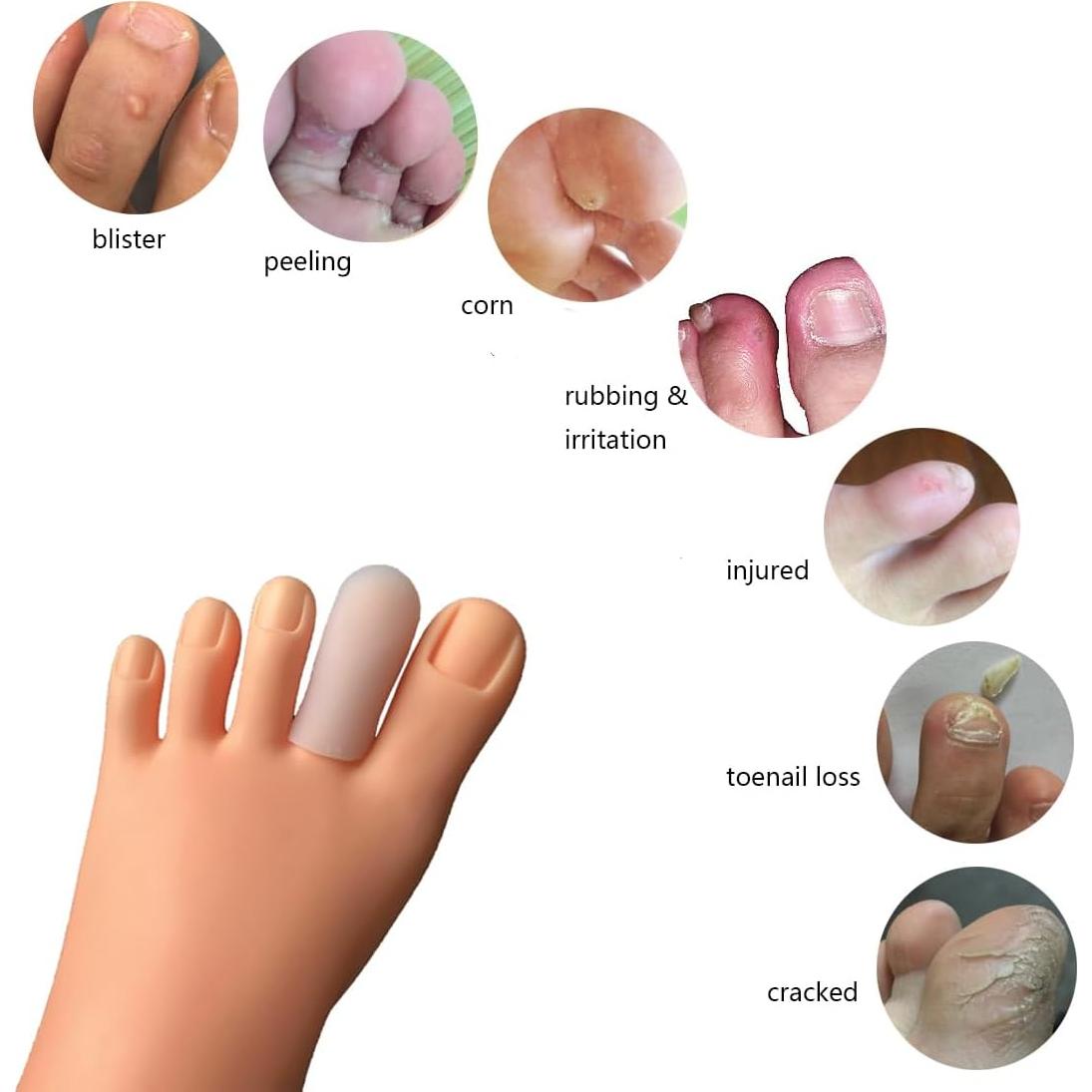 30 Protectores de Dedos Conpru de Goma SEBS para Callos y Ampollas