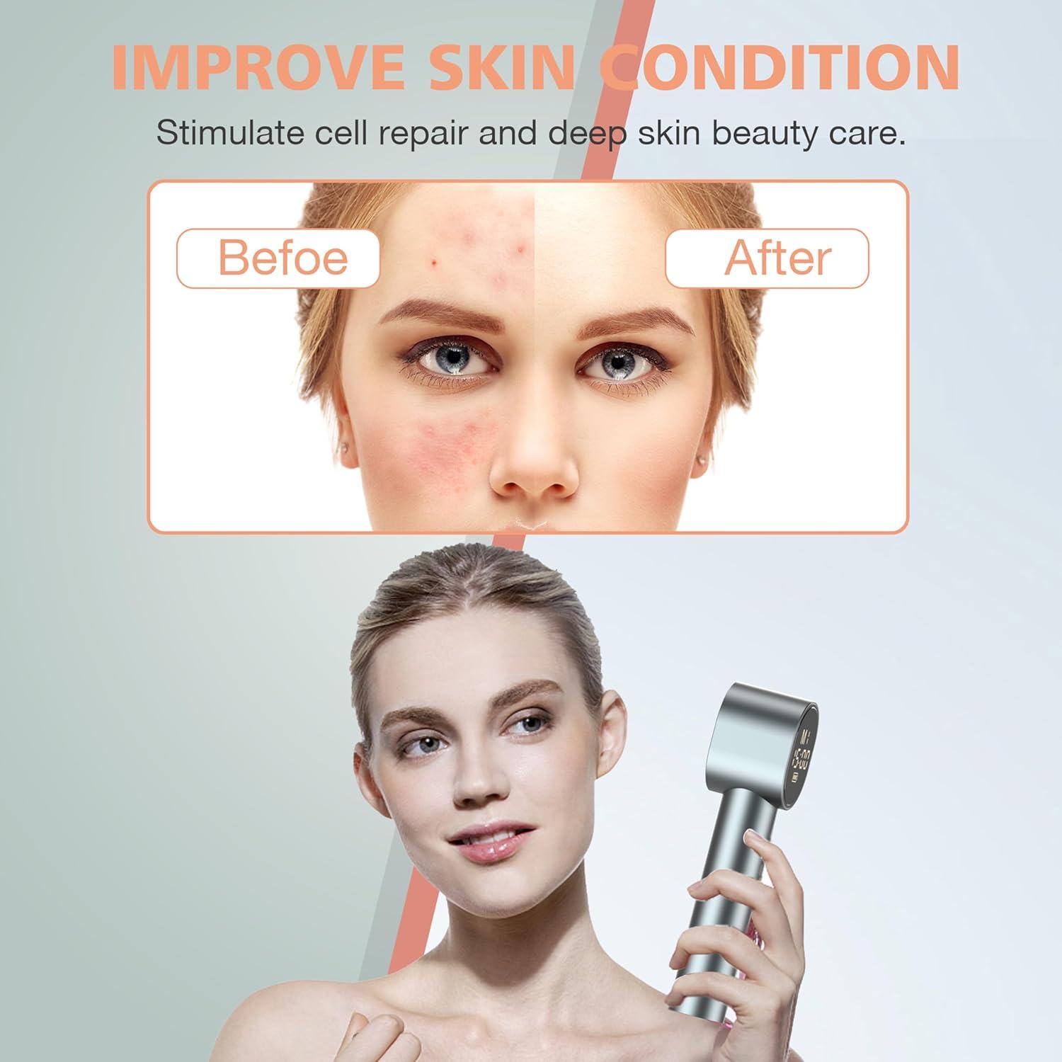 Terapia de Luz Roja Aptoyu 20 LEDs 660/850nm Portátil