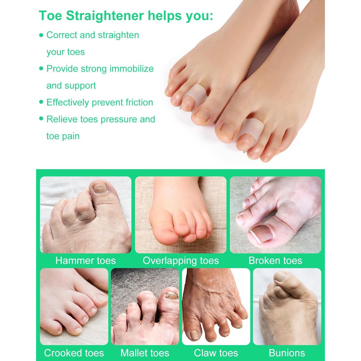 10 Piezas Correctores de Dedos en Martillo PDRODE Pequeño