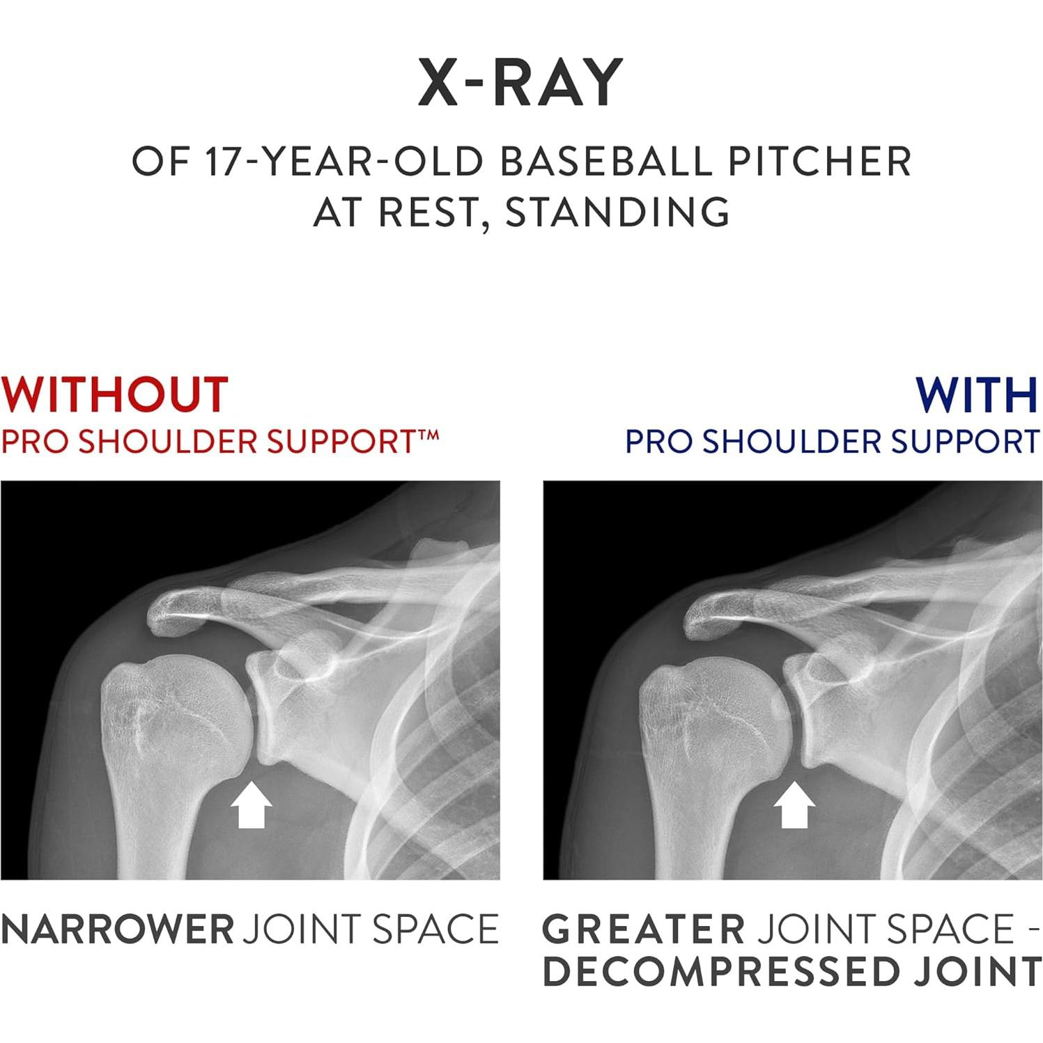Soporte para Hombro OPTP PRO Grande/Extra Grande - Alivio Dolor