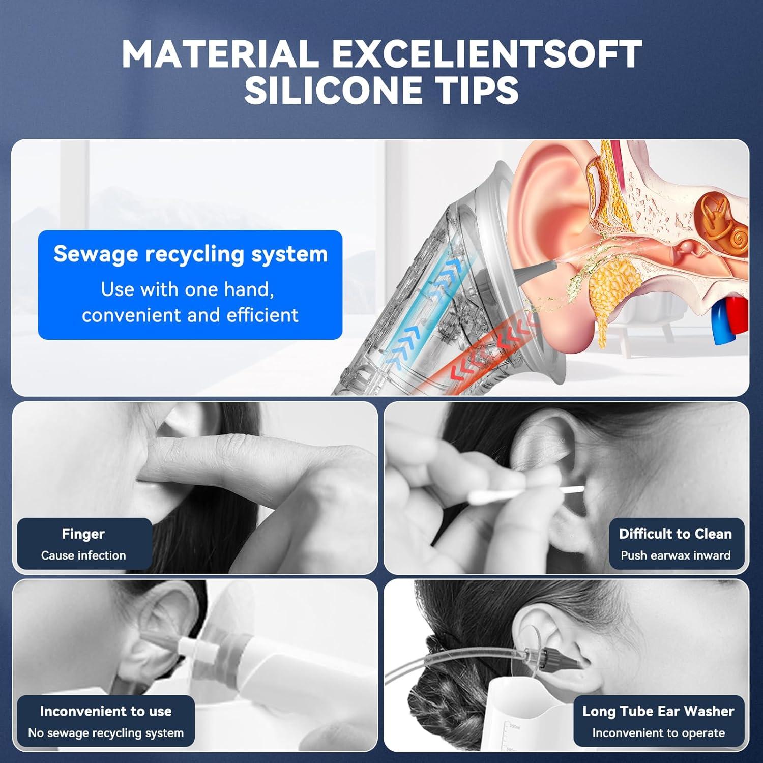 Kit de Eliminación de Cerumen Eléctrico VLINGQI - Limpieza Eficiente