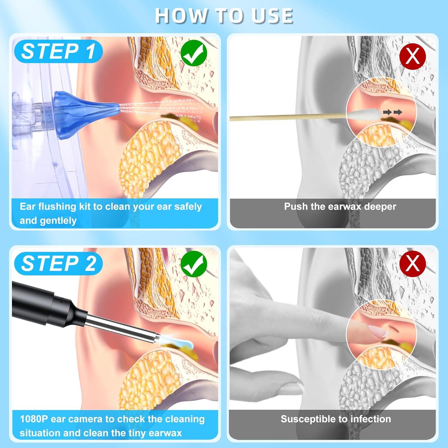 Kit de limpieza de oídos ESHOWEE 2 en 1 con cámara 1080P