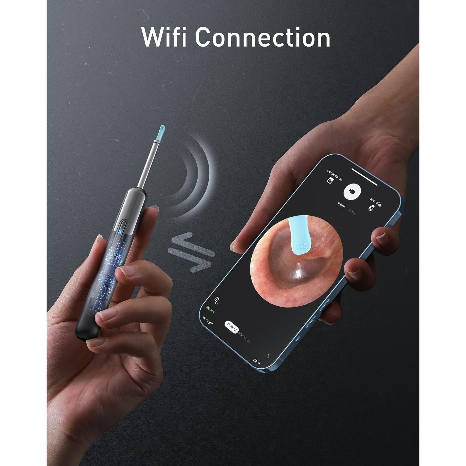 Limpiador de Oídos Yorsfun N5 con Cámara HD 1080P y 6 Puntas