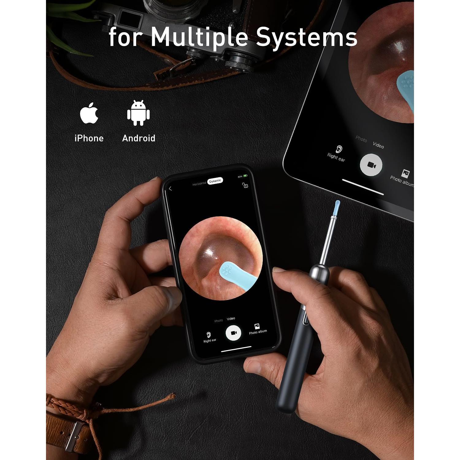 Limpiador de Oídos Yorsfun N5 con Cámara HD 1080P y 6 Puntas