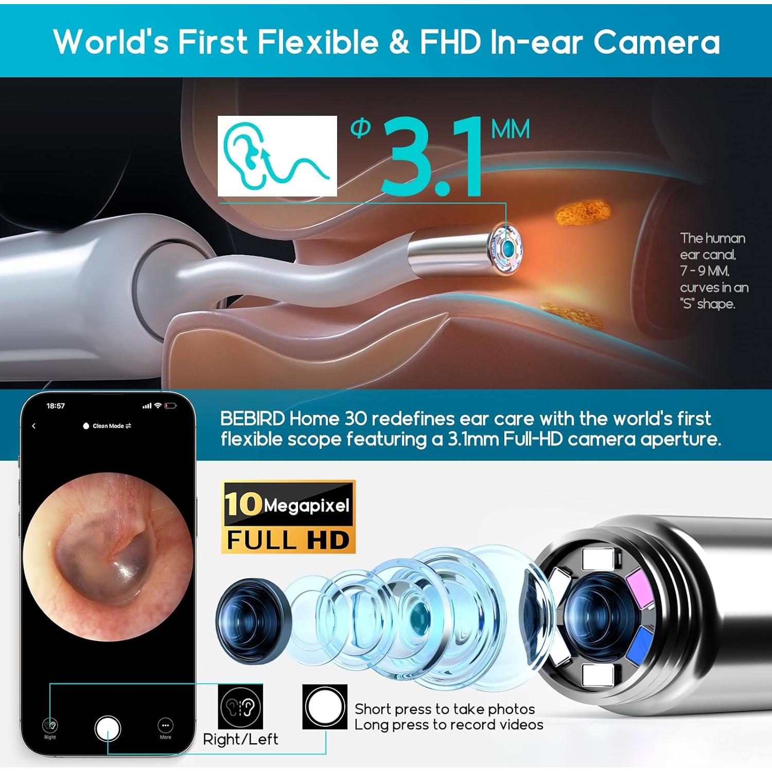 Limpiador de Oídos BEBIRD Home 30S con Cámara FHD y Luz UVC