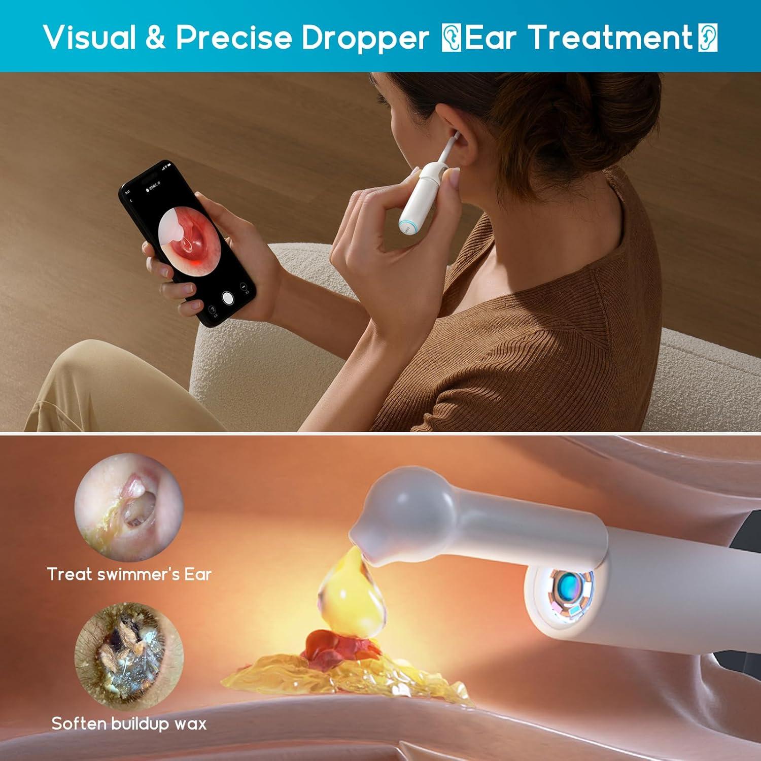 Limpiador de Oídos BEBIRD Home 30S con Cámara FHD y Luz UVC