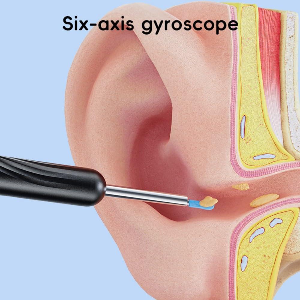 Cámara de Remoción de Cerumen PIGETALE 1080P Inalámbrica