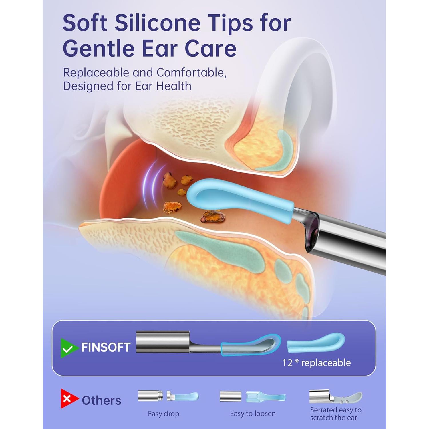 Limpiador de Oídos FINSOFT con Cámara HD 1296P y 10 Puntas