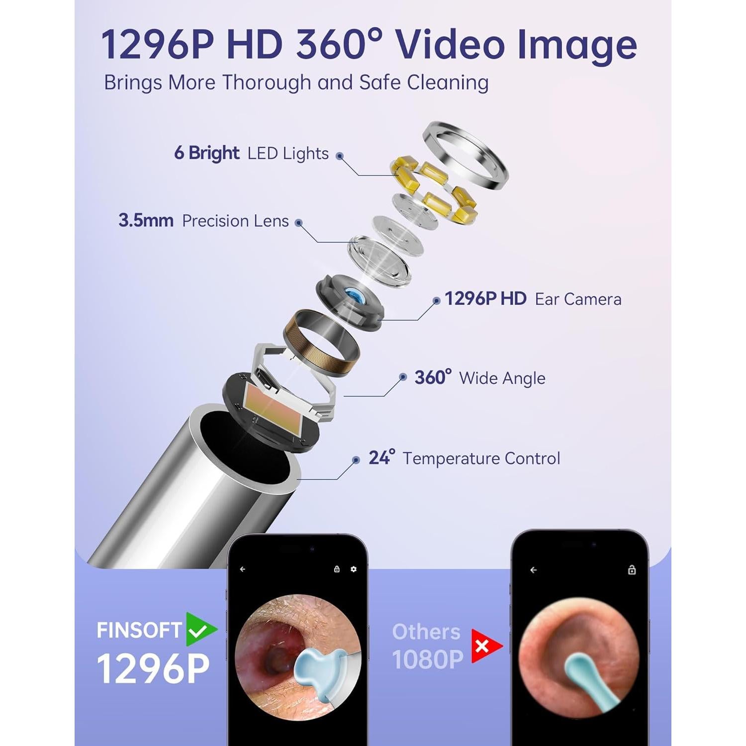 Limpiador de Oídos FINSOFT con Cámara HD 1296P y 10 Puntas