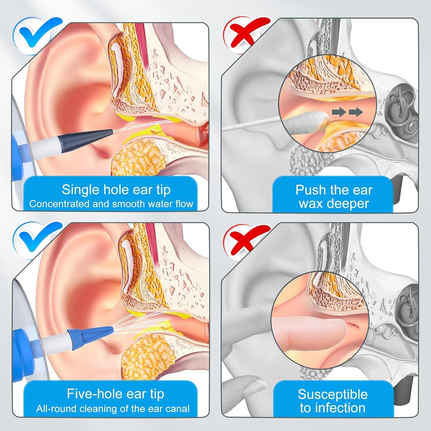 Kit de Limpieza de Oídos Binazon - Irrigación Manual para Cerumen