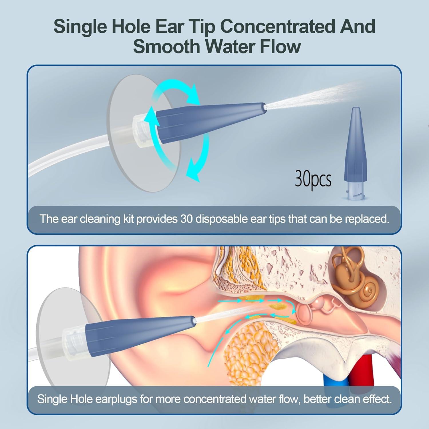 Kit de Limpieza de Oídos Kecowl - Eliminación de Cerumen