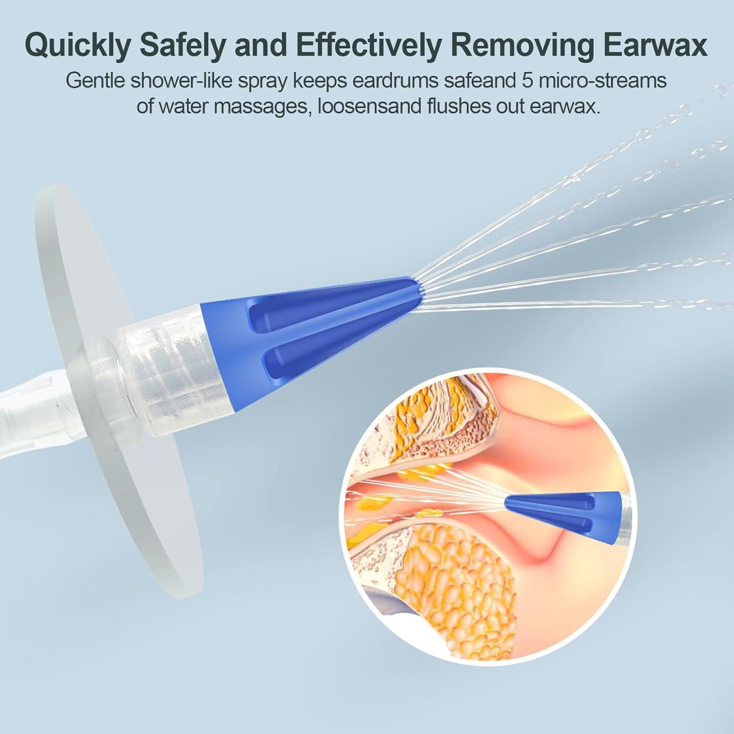 Kit de Limpieza de Oídos Kecowl - Eliminación de Cerumen