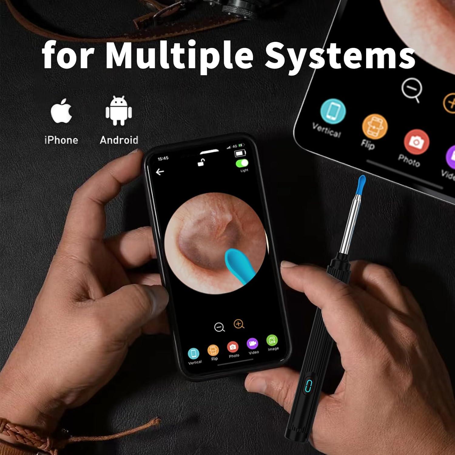 Kit de Limpieza de Oídos con Cámara HD 1080P MSXGSYYDS