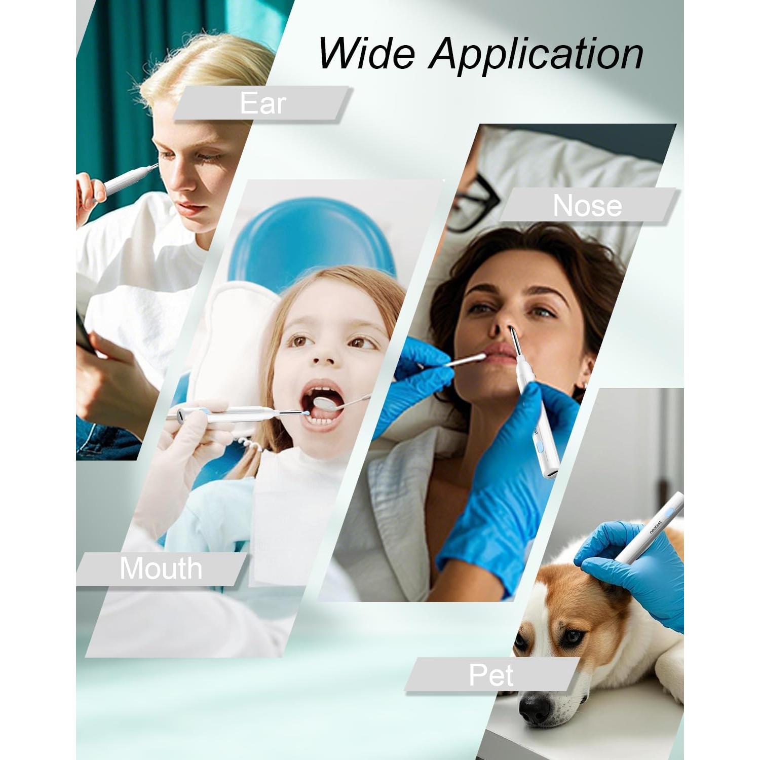 Limpiador de Oídos Inteligente NEATEST con Cámara 1296P