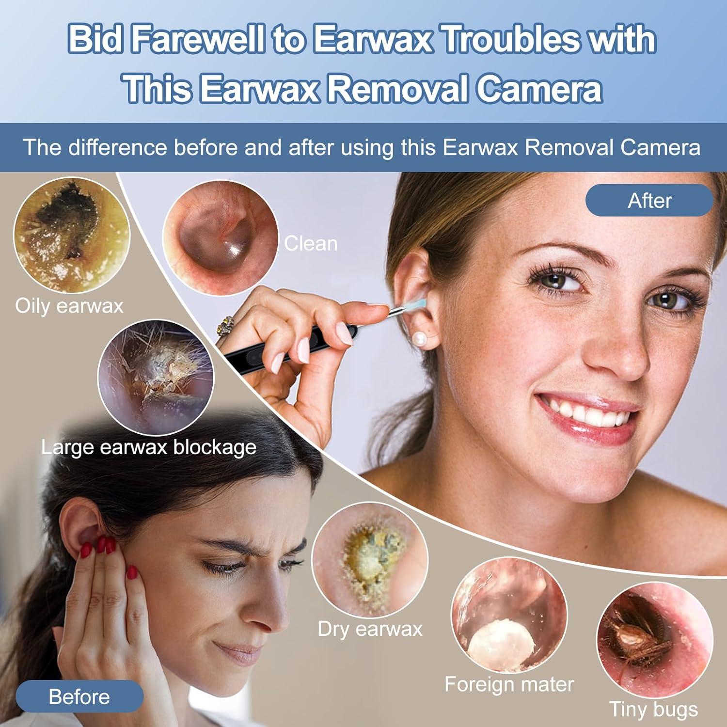 Limpiador de Oído Healthappy con Cámara HD 1080P y LED