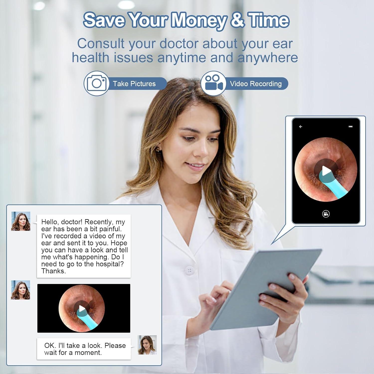 Limpiador de Oído Healthappy con Cámara HD 1080P y LED