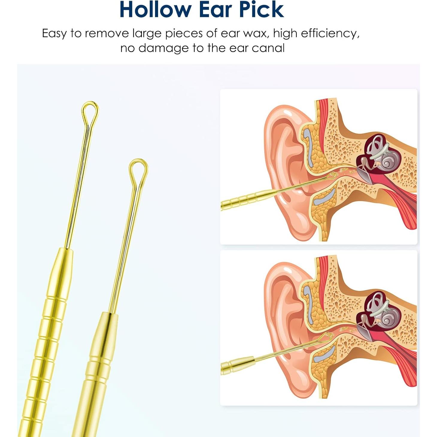 Ear Cleaning Kit,Safe Ear Wax Removal Tool,Earwax Removal Kit,Easy to Use,Painless Ear Pick,with Storage Box and Cleaning Brush (Gold)