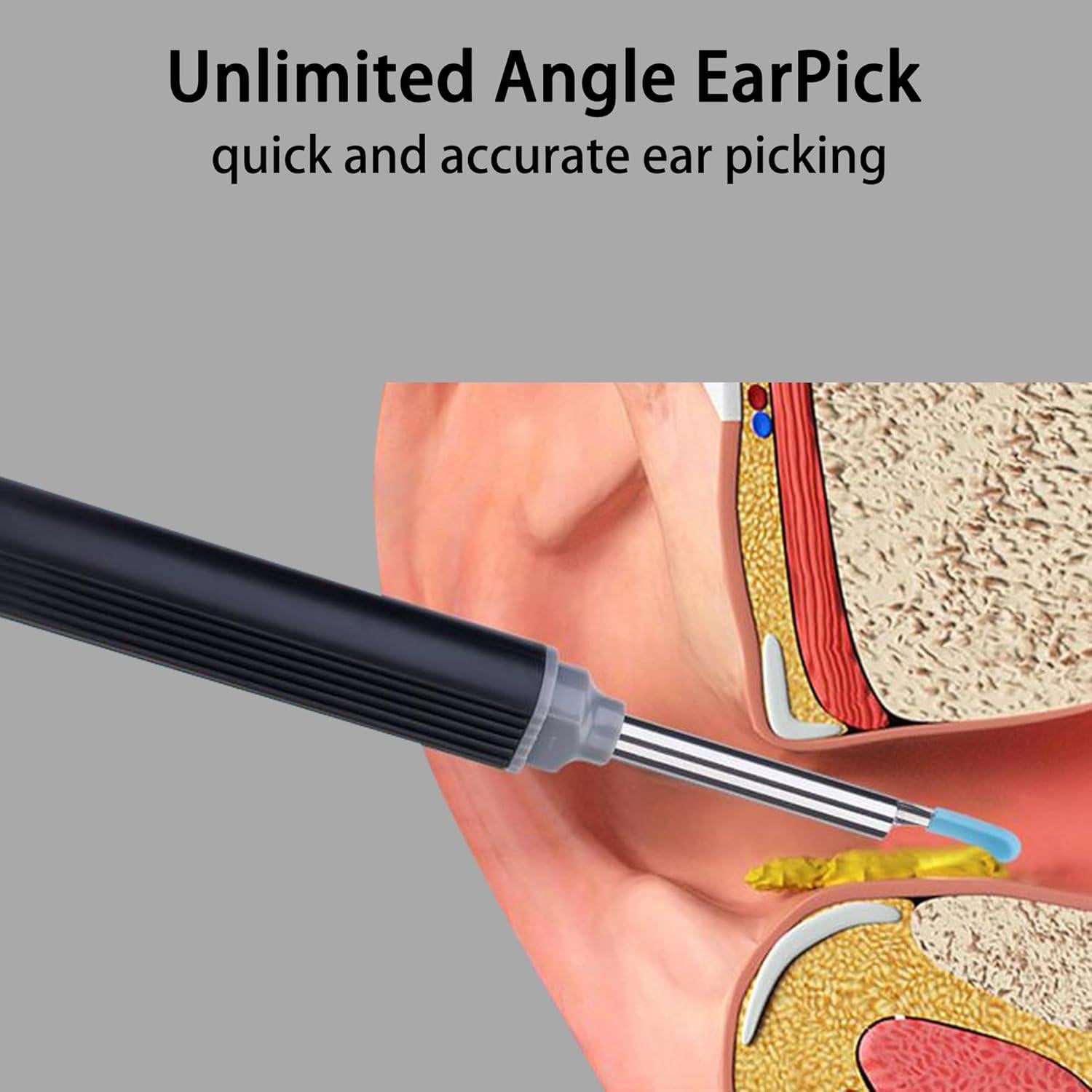 Limpiador de Oídos con Cámara HD 1080P Yunwei, Carga Rápida