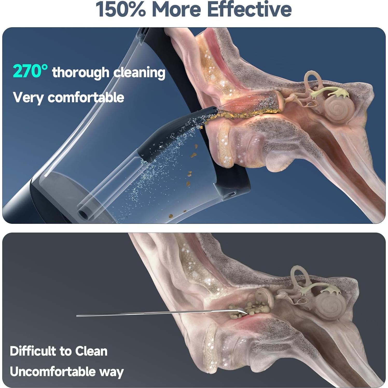 Kit de Limpieza de Oídos Eléctrico Baria con 4 Modos de Presión