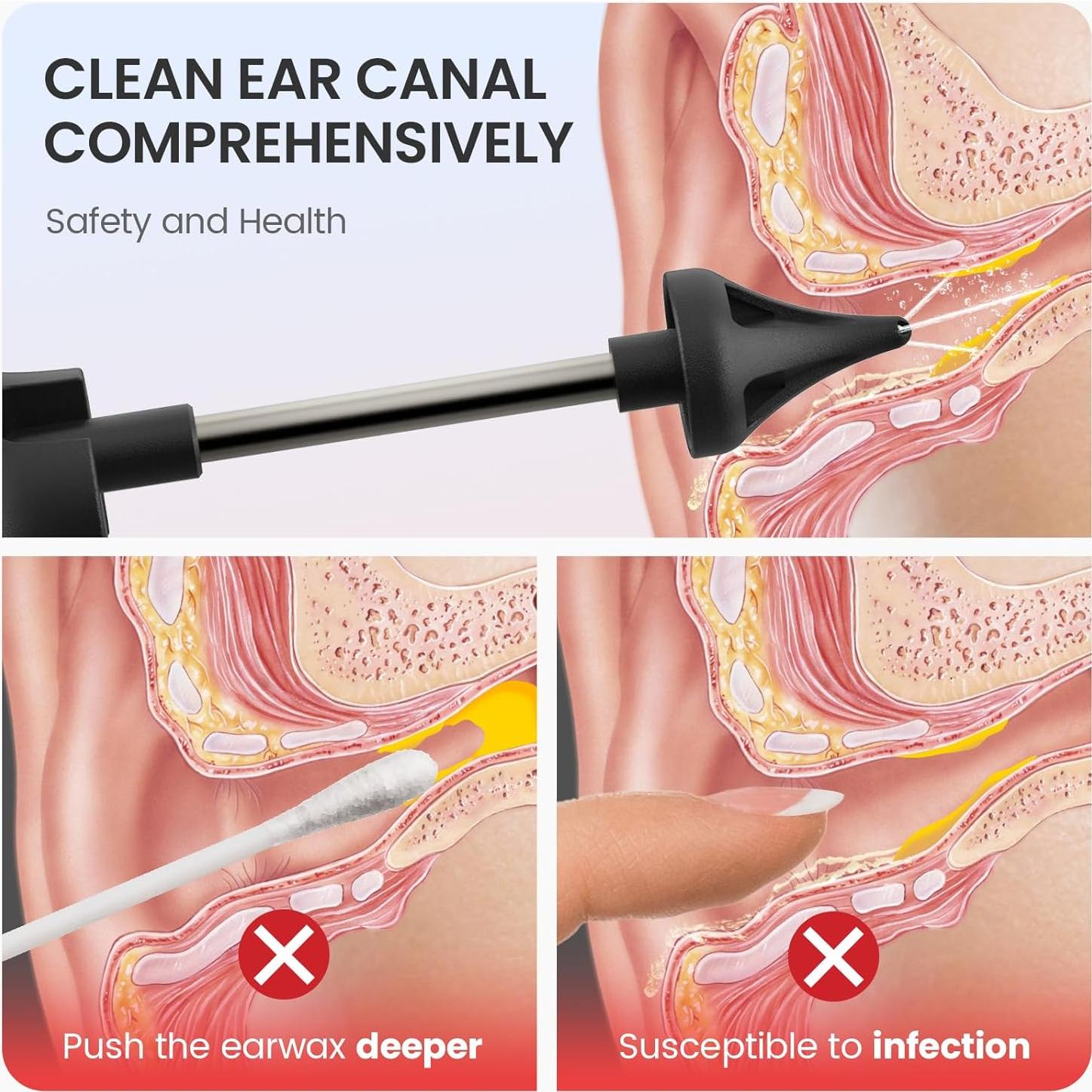 Kit Limpiador de Cerumen IPX5 Havenit 6 Piezas 12.7cm