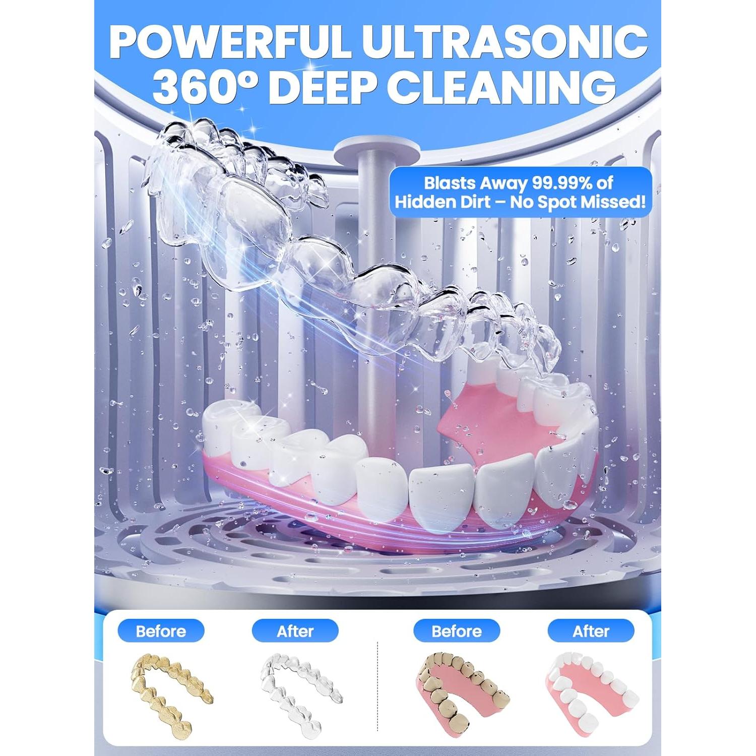 Dental Ultrasonic Retainer Cleaner Machine: Nicwell 200ML Denture Cleaner, Deep Cleaning Mouth Guard Cleaner, Aligner Cleaner, NightGuard Cleaner with Protection Design for Braces, Oral Dental & Tray