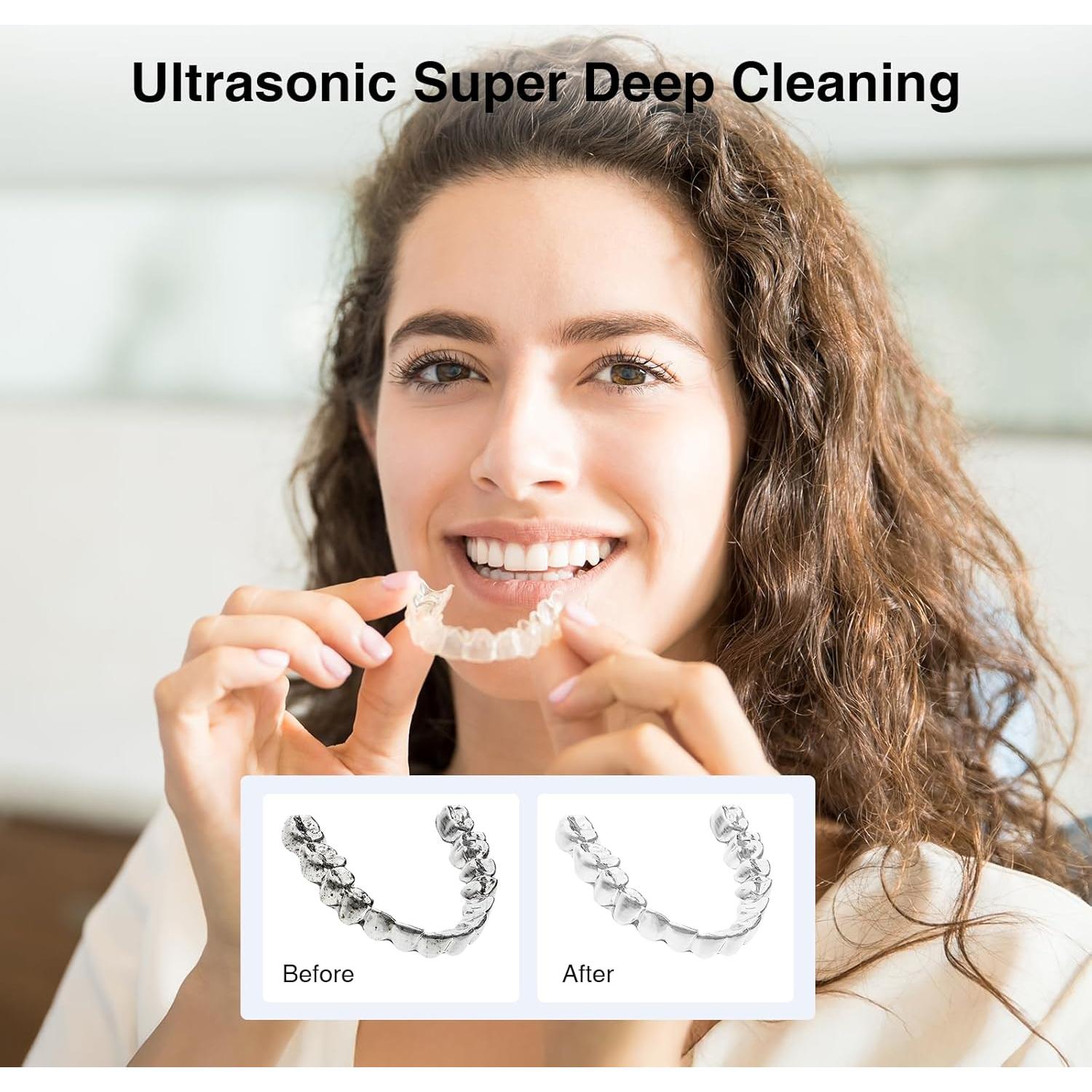 Limpiador Ultrasónico de Retenedores Zoelafe 200ml 45kHz