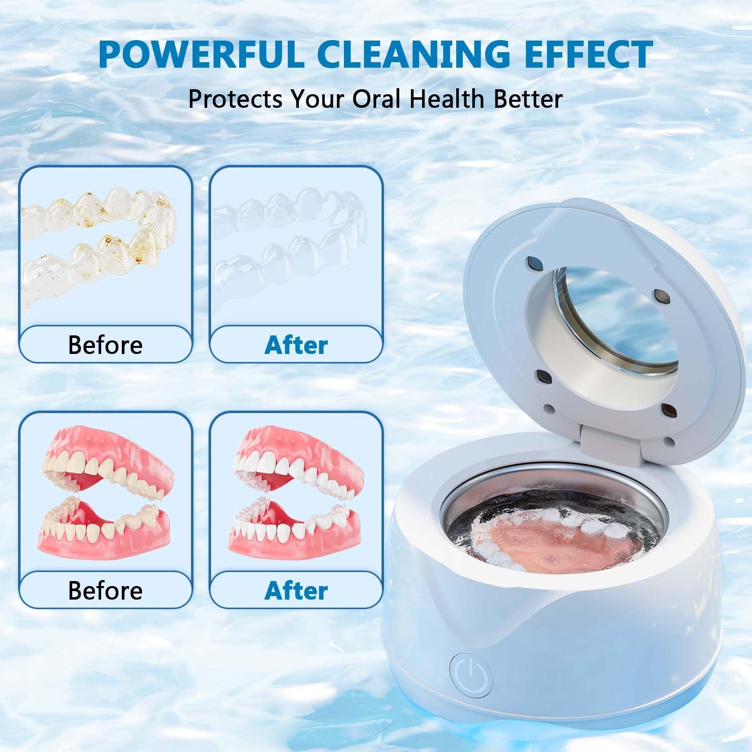 Limpiador Ultrasónico Portátil Xiyi 200ml para Retenedores Dentales