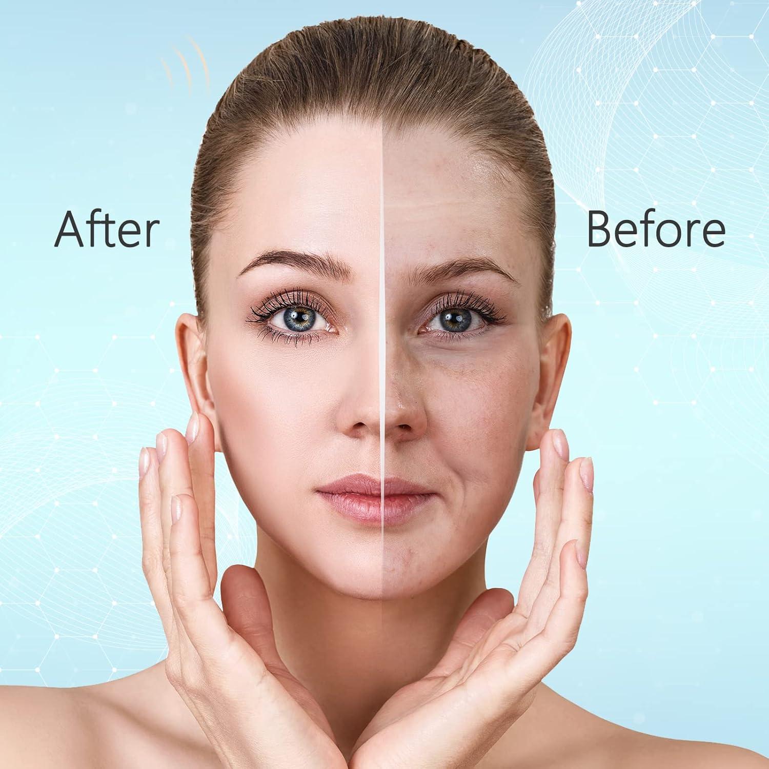 Varita de Alta Frecuencia YourMate para Facial y Cabello - 4 Tubos