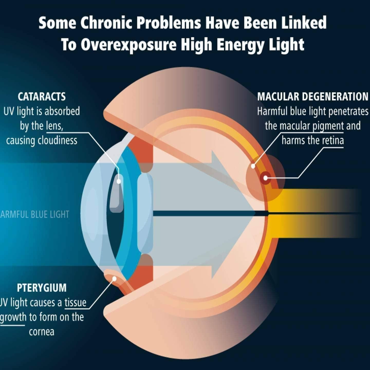 Protector de Pantalla Vidrio Templado ZenHoo para Google Pixel 7