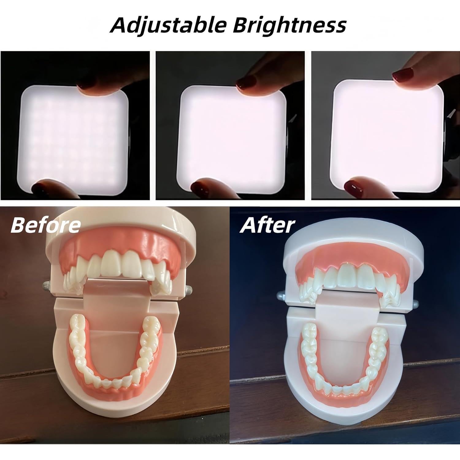 Luz Dental Portátil RXLIFE LED Recargable con Bolsa 0.63kg