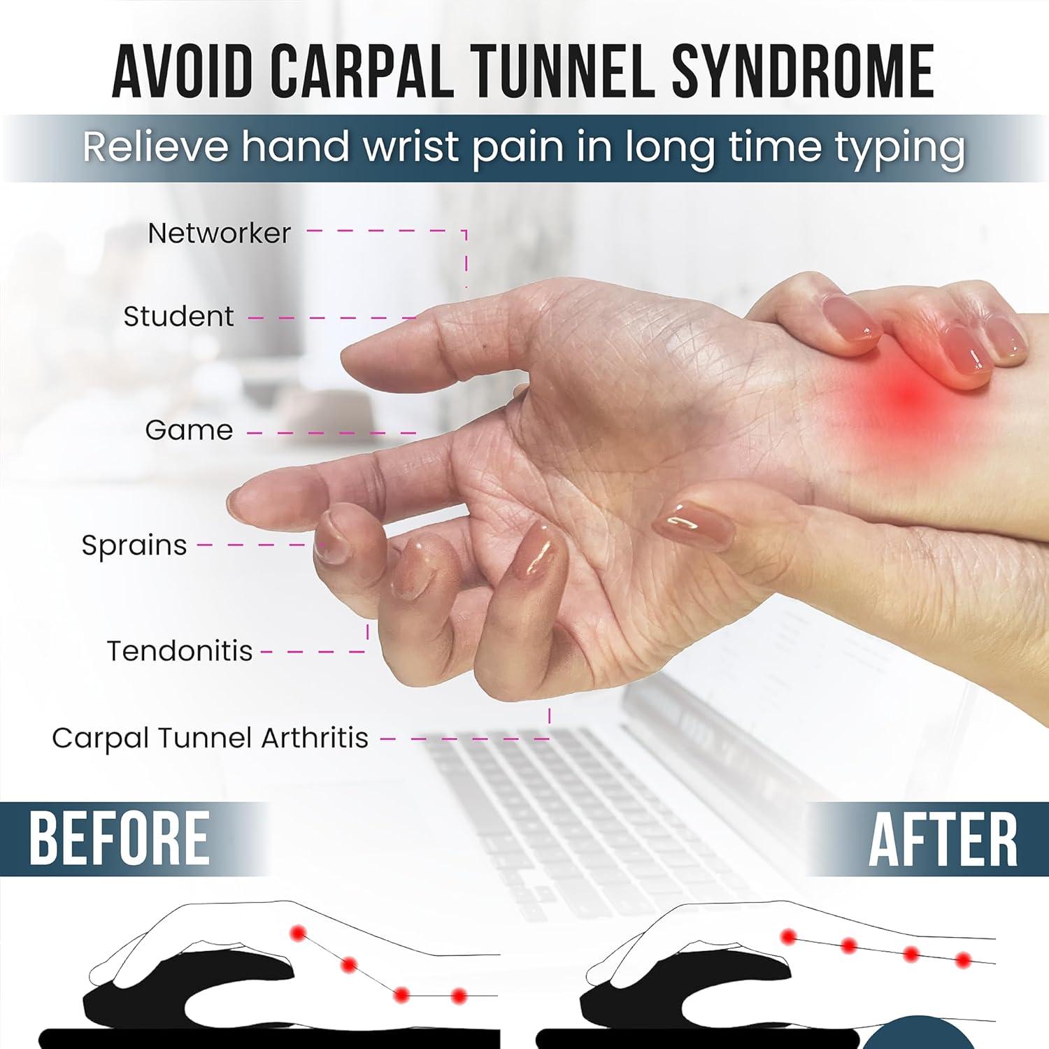 Almohadillas para Muñeca Ergonómicas EXPOPROX - Gel Acolchado