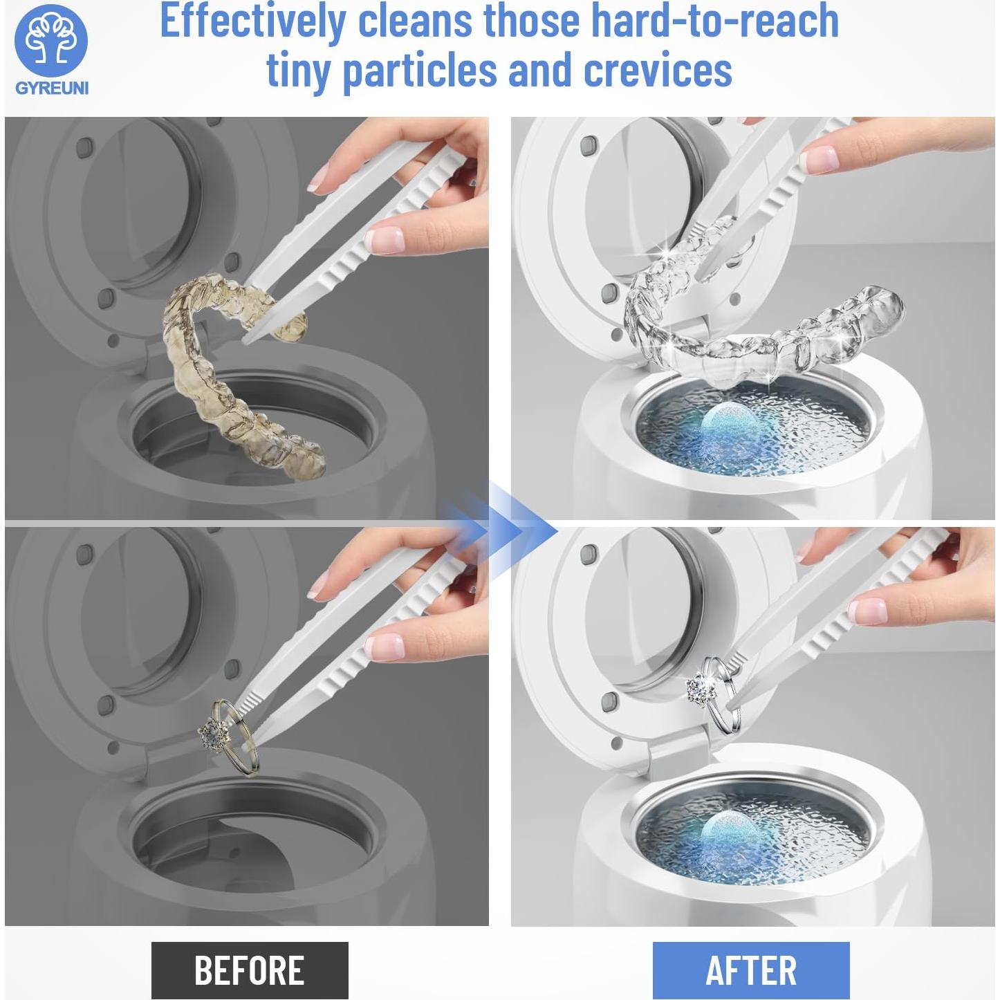 Limpiador ultrasónico Gyreuni para retenedores y aparatos dentales