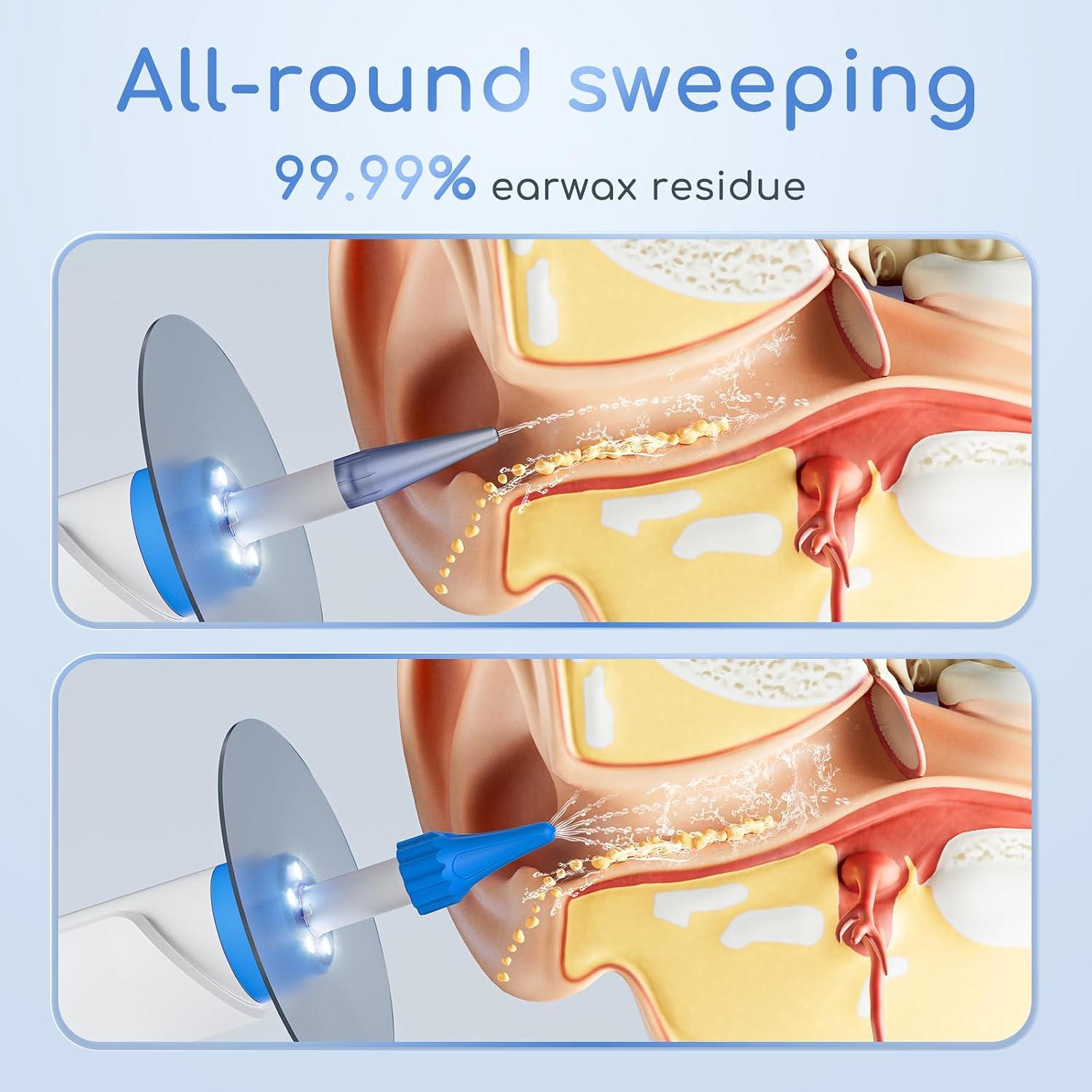 Kit de Limpieza de Oídos Eléctrico ENIFER con Cámara 1080P