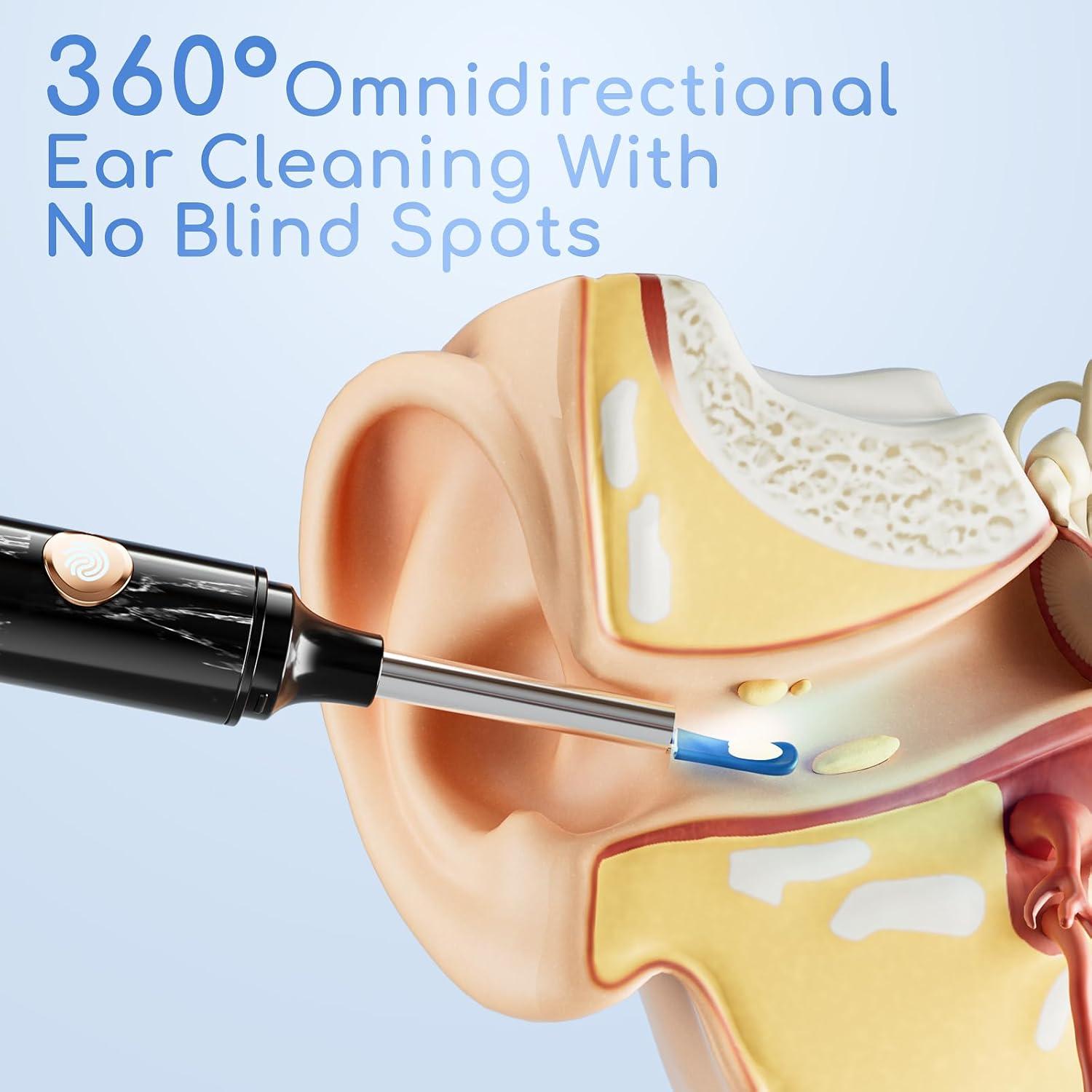 Kit de Limpieza de Oídos Eléctrico ENIFER con Cámara 1080P