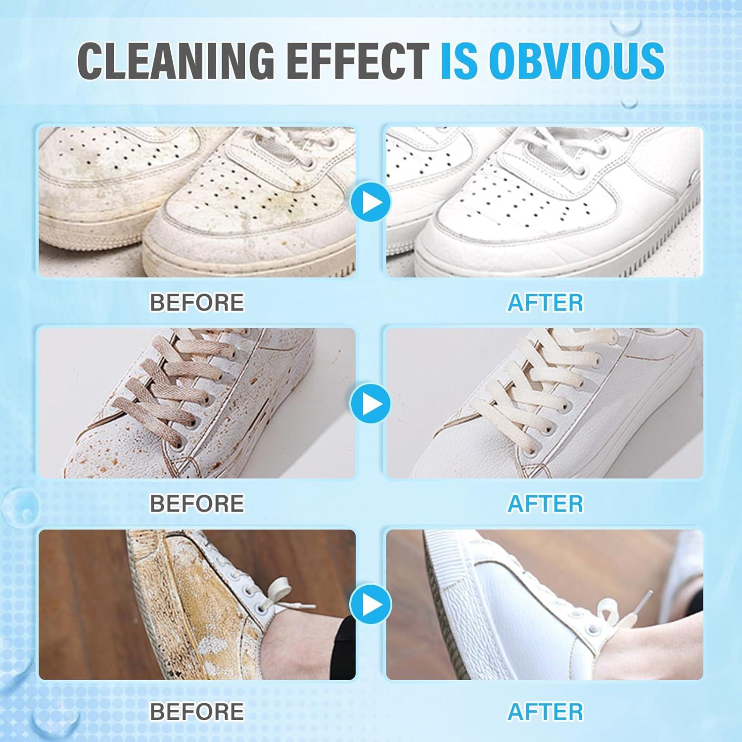 400ml Advanced Shoe Cleaner Kit for White Sneakers,Leather & Suede Shoes – All-in-One Cleaning Solution for Tennis Shoes,Brogues,Trainers | Includes Soft Brush | Quick-Dry Formula