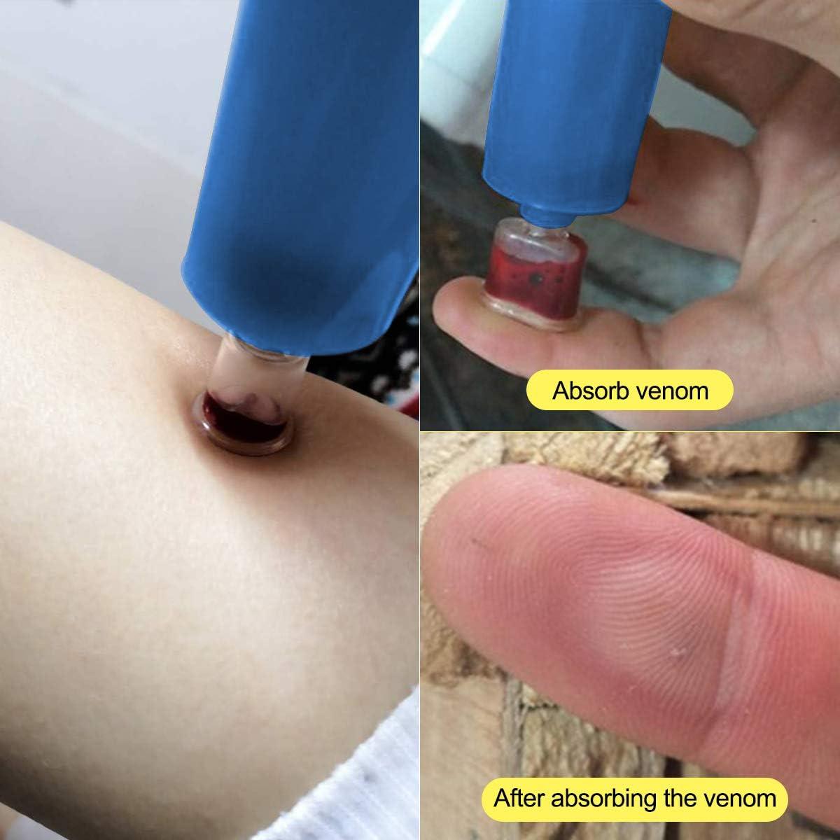 Kit de primeros auxilios DLY para mordeduras y picaduras